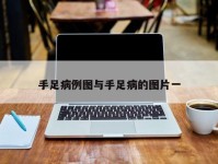 手足病例图与手足病的图片一