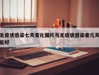 无症状感染七天变化图片与无症状感染者几天能好